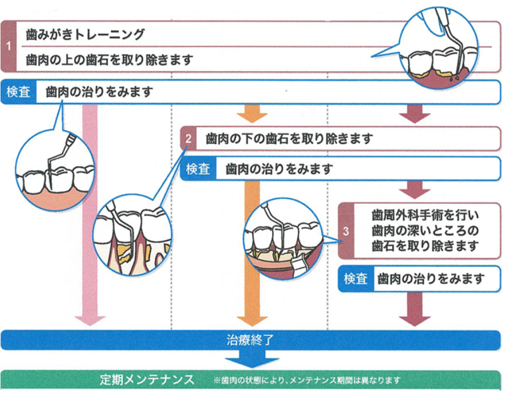 歯周病